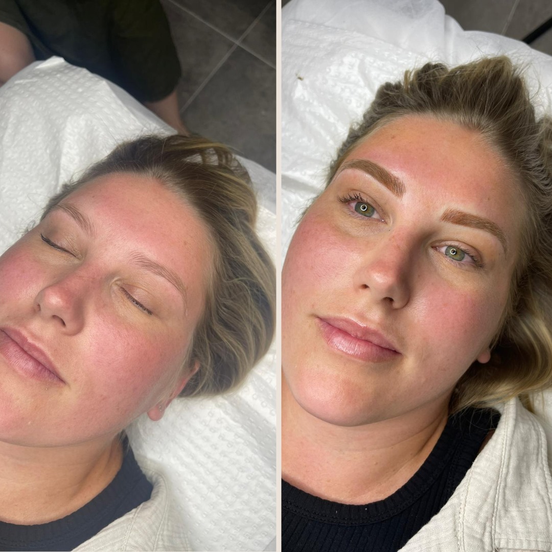 Before and after cosmetic brow tattoo transformation