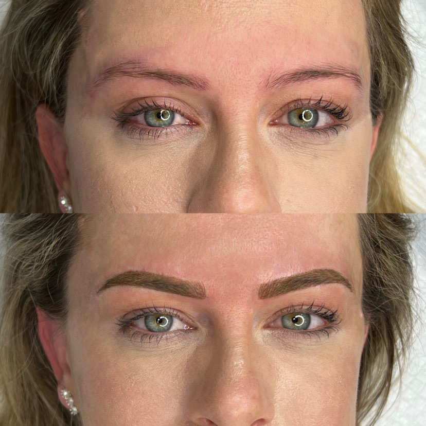 Before and after cosmetic brow tattoo result — sparse blonde brows transformed to defined hair-stroke brows